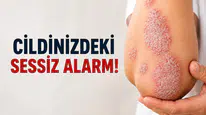 Cildinizdeki Sessiz Alarm!