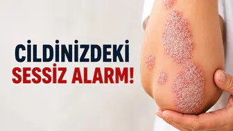 Cildinizdeki Sessiz Alarm!