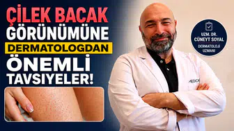 Çilek Bacak Görünümüne  Dermatologdan Önemli Tavsiyeler!