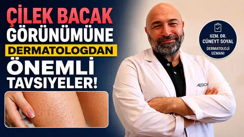 Çilek Bacak Görünümüne  Dermatologdan Önemli Tavsiyeler!