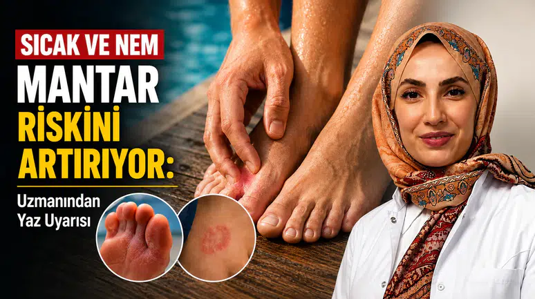 Sıcak ve Nem Mantar Riskini Artırıyor: Uzmanından Yaz Uyarısı